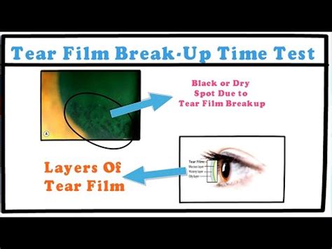 can you test tears|tear break up time.